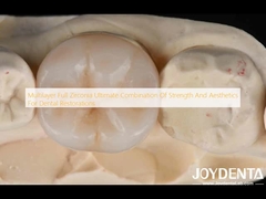 Multilayer Full Zirconia Ultieme combinatie van sterkte en esthetiek voor tandheelkundige restauratie