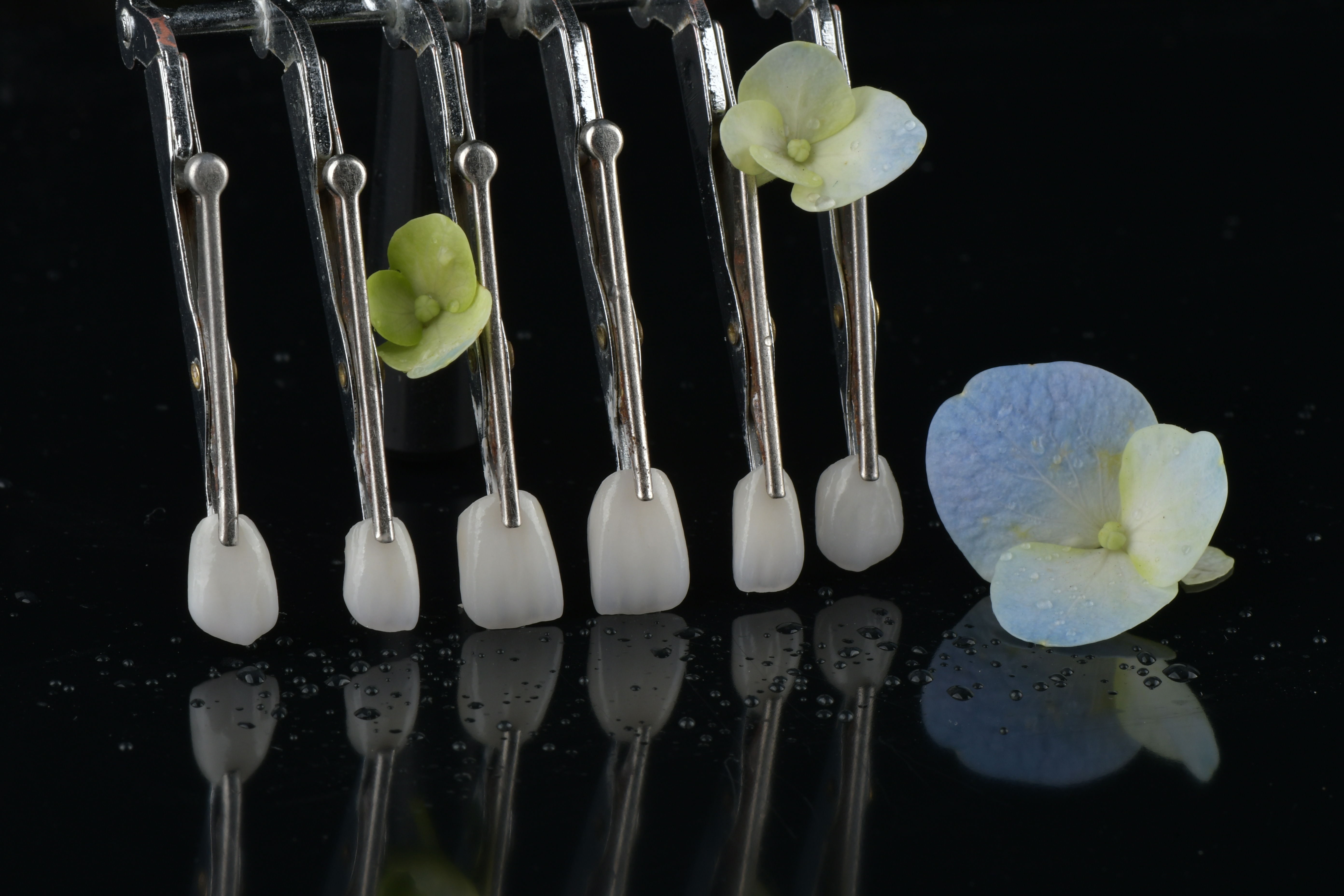 Laatste bedrijfsblogs Vereisen vaste restauraties vervolgafspraken?