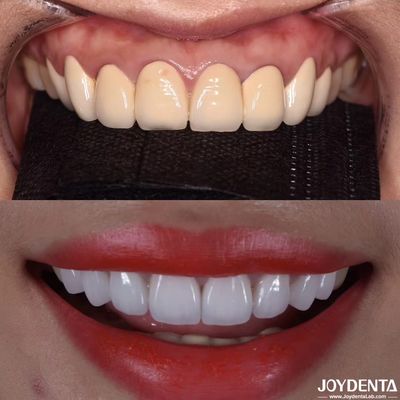CAD/CAM-compatibele Zirconia tandheelkundige kronen Precision Manufacturing voor op maat gemaakte kleuren en maten