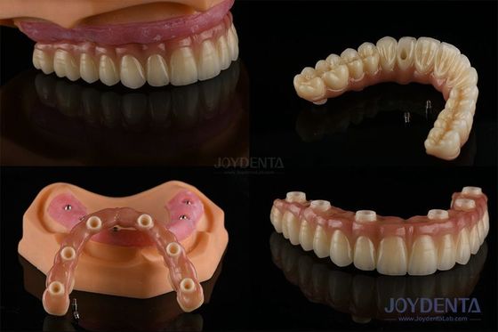 kopen Tandheelkundige vervanging van meerdere tanden Implantaten Ruwe oppervlakken Prothesecomponenten online vervaardiging