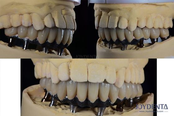 kopen Titanium Meerdere tanden Tandheelkundige implantaten Prothese chirurgie Externe zeshoekige verbinding online vervaardiging