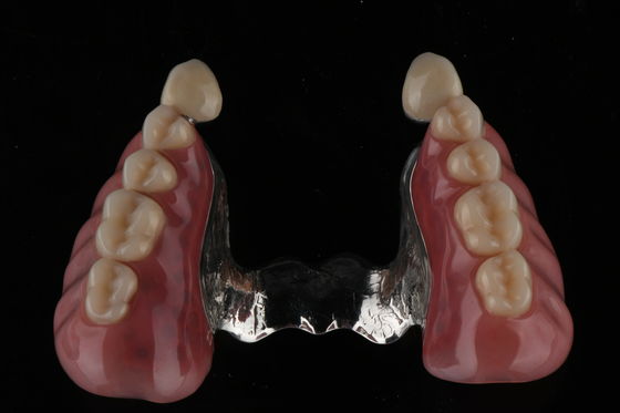 kopen Vlek- en geurbestendige volledige acrylprothese met een natuurlijk uiterlijk Acrylhars-prothese online vervaardiging