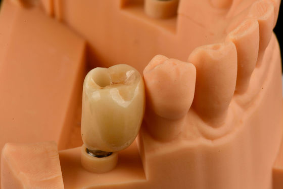 kopen Interne hex-verbinding Zandgeblazen Titanium tandheelkundige implantaten Eenvoudige tandvervanging online vervaardiging