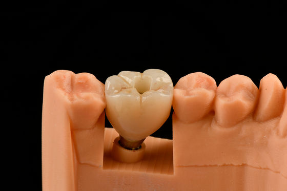 kopen 10 mm Titanium Tand Implantaten Zandblazen Zelf Tapping Tand Implantaten online vervaardiging