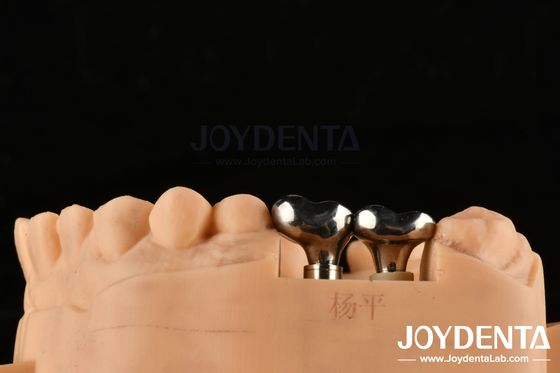 kopen Zilveren tandheelkundige implantaten Abutments Aanpasbare diameter Hoogte CAD CAM-technologie online vervaardiging