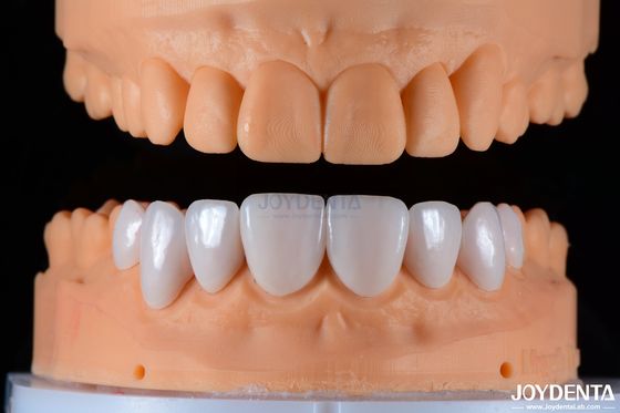 kopen Veilig geschikt porselein veneers Keramische en natuurlijke esthetiek met sterke hechting online vervaardiging