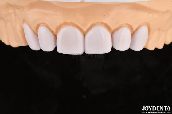 kopen Biocompatibiliteit en zachtaardigheid op mondweefsels online vervaardiging