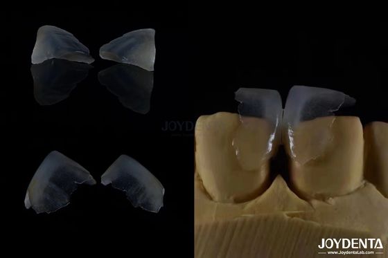 kopen Minimaal invasieve cosmetische tandheelkundige fineer glas keramische kleur ultra dun online vervaardiging