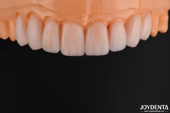 kopen Aanpasbaar glas keramische fineer natuurlijke uitstraling hoge chemische weerstand online vervaardiging
