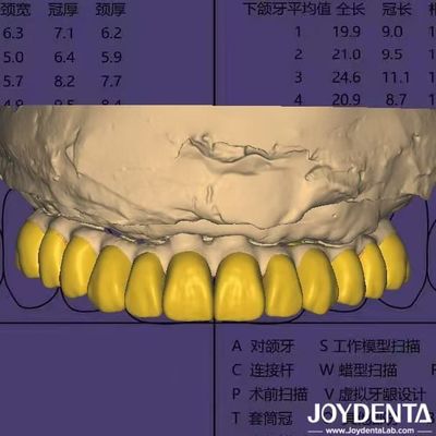 kopen Software voor tandheelkundig ontwerp Digitaal Wax Up met HIPAA-compliant gegevensbeveiliging online vervaardiging