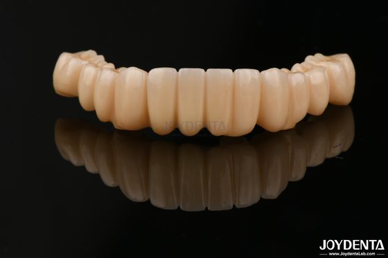 kopen Hoge precisie volcontour Zirconia hoge vlekbestendigheid voor tandheelkundige toepassingen online vervaardiging