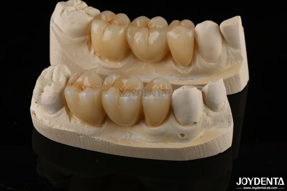 kopen Gebruikbestendige Zirconia Full Contour Tandkronijn Hoge doorschijnendheid online vervaardiging