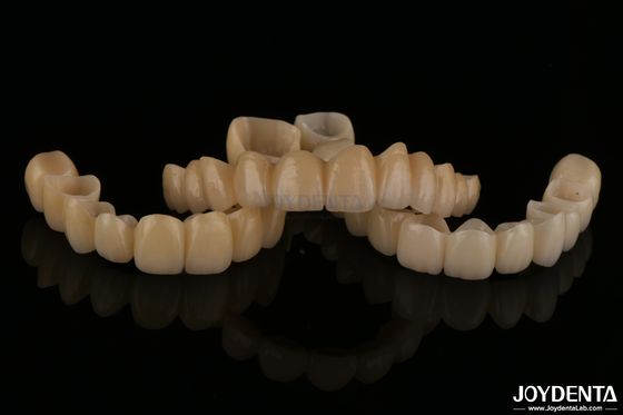 kopen Natuurlijk uitziende porseleinen gelaagde zirconia bruggen slijtvastheid hoge biocompatibiliteit online vervaardiging