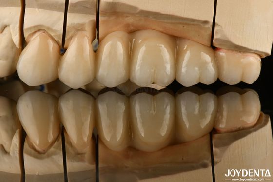 kopen Natuurlijk uitziende meerlagig volledig Zirconia voor tandheelkundige restauratie Ultratranslucent online vervaardiging