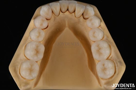 kopen 3D Multi-Layer Tandheelkundige Volledige Zirconia Chipping Resistance Natuurlijke tandstructuur online vervaardiging