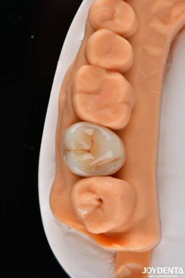 kopen Tandheelkundige meerlagige full zirconia kronen en bruggen hoog doorschijnend natuurlijk uiterlijk online vervaardiging