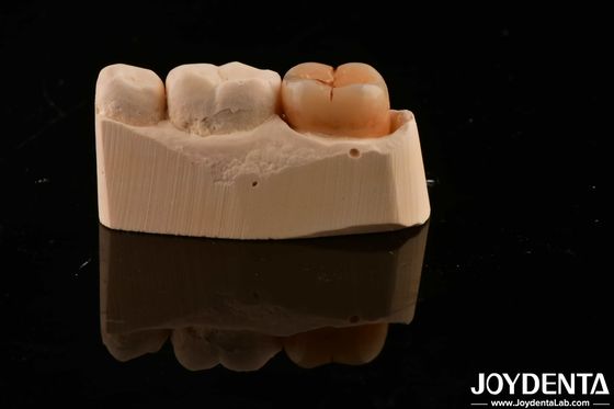 kopen Tandheelkundig herstelmateriaal Meerschaalvol Zirconia 1200 HV Hardheid Krakbestandheid online vervaardiging