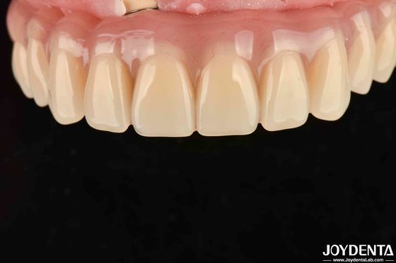 kopen Snelle drooging 5 minuten Acryl tanden afwerking voor tandheelkundige tandherstel online vervaardiging