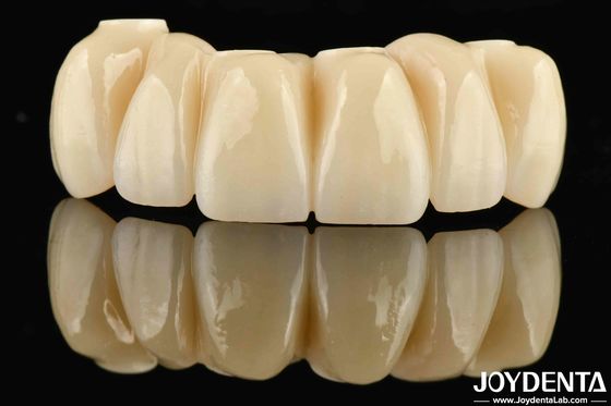 kopen Tandheelkundige restauratie Ti-Base Zirconia Hybride Bridge Natuurlijk uitziende Precise Fit online vervaardiging