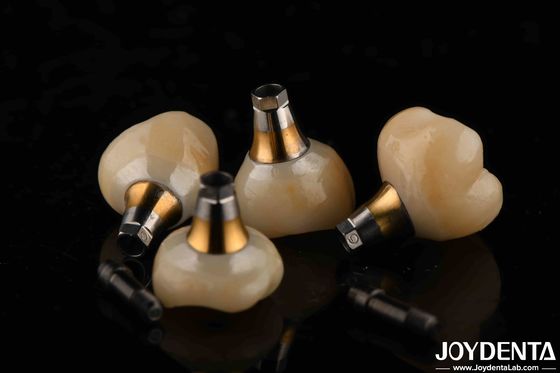 kopen 4.1mm Diameter Titanium Tandheelkundige Afgeronde Abutments Zilver Met Draad Pitch 1.5mm online vervaardiging