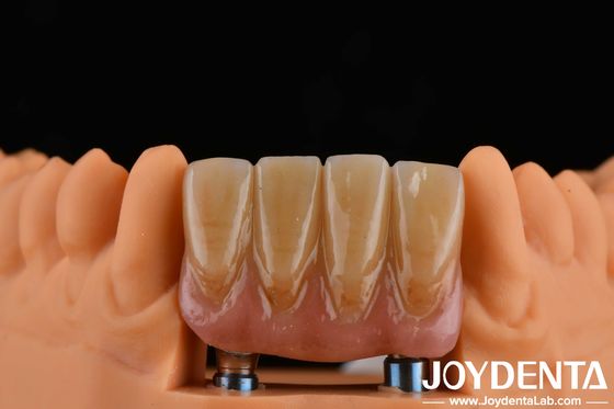 kopen 4.5 mm Hoogte Afgewerkte abutments Interne hex-verbinding Type compatibel met implantatiesystemen online vervaardiging
