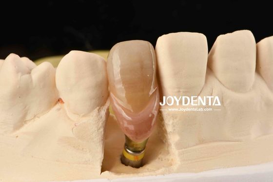 kopen 0° Hoek Afgewerkte tandheelkundige abutments 1,5 mm draadpitch Gepolijst oppervlak online vervaardiging