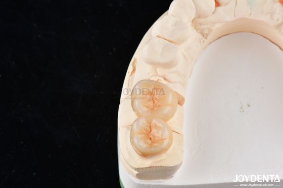 kopen Natuurlijk uitziende tandheelkundige Zirconia Inlays En Onlays High Esthetisch Precise Fit online vervaardiging
