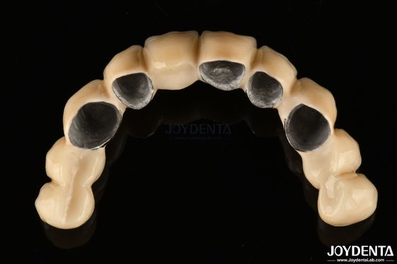 kopen PFM-keramiek gesmolten met metaalkroon hoog biologisch compatibel en corrosiebestendig online vervaardiging