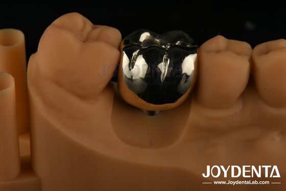 kopen Mondrehabilitatie Wax Casting FMC Full Metal Crown voor tandheelkundige klinische reparatie online vervaardiging
