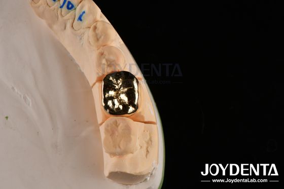 kopen Abrasieve weerstand Tandwax Giet FMC kroon voor orale klinische reparatie online vervaardiging