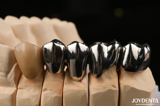 kopen Oral Clinical Repair FMC Full Metal Crown gemaakt met Wax Casting Productie methode online vervaardiging