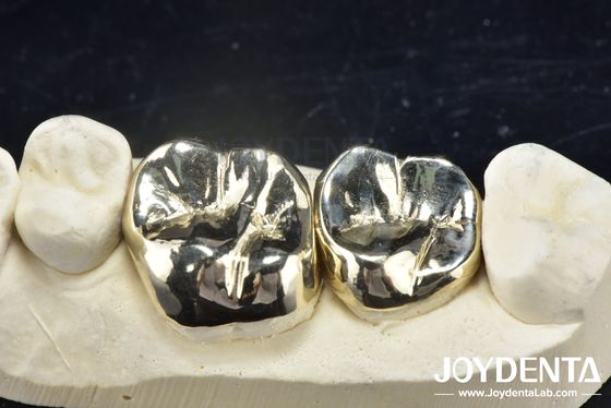 kopen Wax Casting Tandheelkundige reparatie Volle metalen kroon Voor slijtagebestendige orale revalidatie online vervaardiging