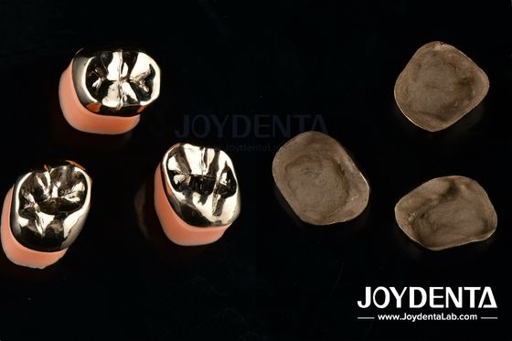 kopen Tandheelkundige restauratie Gouden metalen kronen voor de behandeling van de mondrehabilitatie online vervaardiging