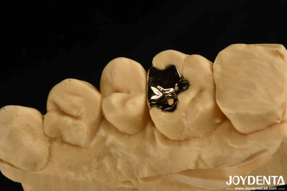 kopen Kliniek Metalen Tandheelkundige Gouden Kroon 60K Gouden Tand Kap Voor Mond Rehabilitatie online vervaardiging