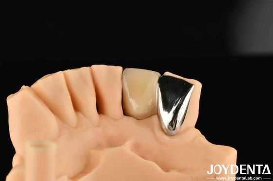 kopen Tandheelkundige metaal / Maryland Bridege Orale klinische reparatie Metalen ideale kleur Klinische binding online vervaardiging