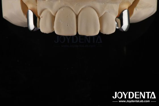 kopen Precision Removable Prothesis Tandheelkundige implantaten Aanhangsels Makkelijk schoon Comfortabel passen online vervaardiging