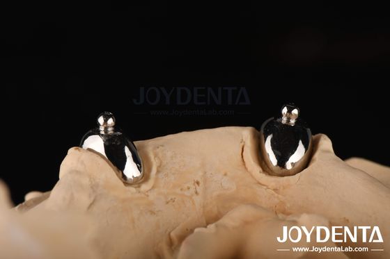 kopen Joydental tandheelkundig lab Ball Aanhangsel online vervaardiging