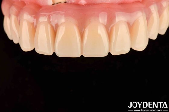 kopen Tandheelkundige behandeling Hoge elasticiteit Acryl valse tanden afwerking voor tandarrangement online vervaardiging