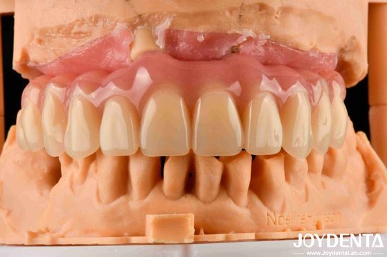 kopen Comfortabel te dragen Acrylprothese afgewerkt met tandarrangement technologie online vervaardiging