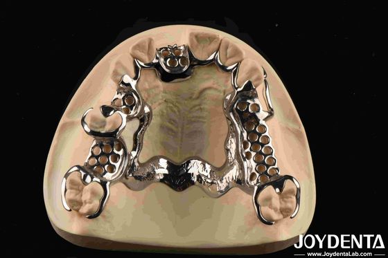 kopen Gepersonaliseerde flexibiliteit Metalen frame tandheelkundig biocompatibel materiaal online vervaardiging