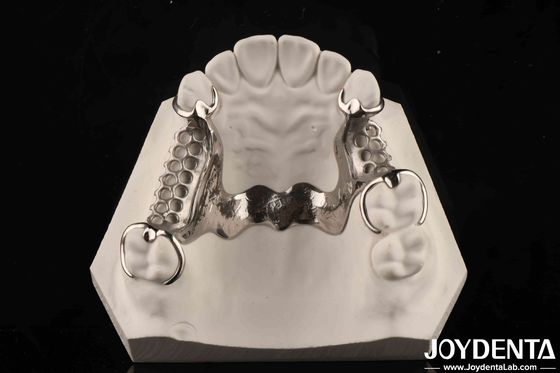 kopen Klinische praktijk Tandheelkundige legeringsmetalen frame Good Fit In The Mouth Technology online vervaardiging