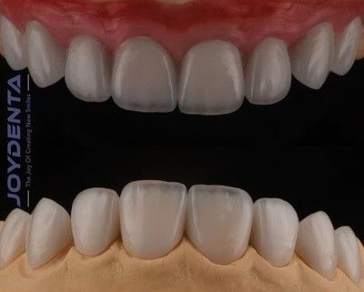 kopen Hoogtranslucent Feldspatisch Finer, Cosmetisch Porselein Finer Met Sterke Hechting online vervaardiging