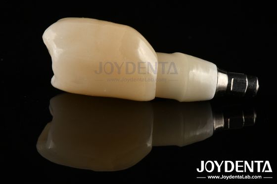 kopen Schoudermarge Design Tandheelkundige Implantaten Bars Voor Breed Prothese Platform Behoeften online vervaardiging