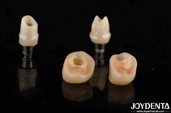 kopen Zilverkleurig tandheelkundig Zirconia-abutments voor implantaten Aanpasbare diameter online vervaardiging
