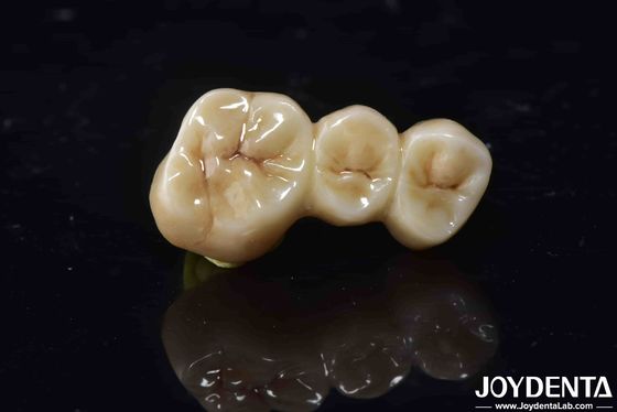 kopen Hoge biocompatibiliteit Zirconia Full Contour Crown Perfect Fit Hoge sterkte online vervaardiging