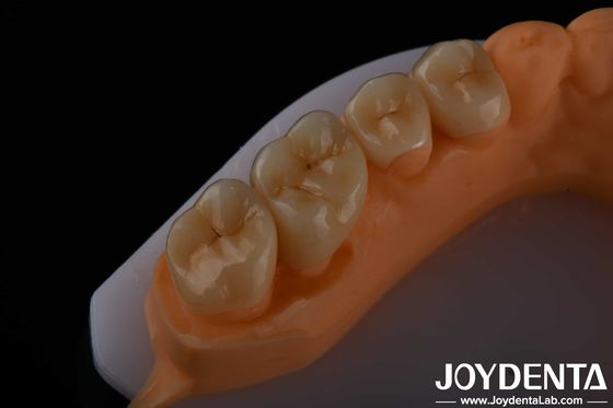 kopen Hoge esthetiek Volledige contour Zirconia Voor kronen Bruggen Implantaten Tandheelkundige restauraties online vervaardiging