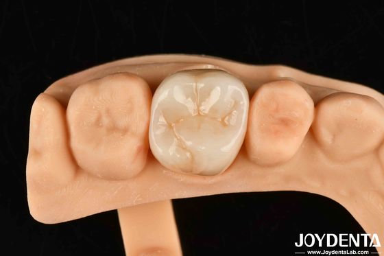 kopen Hoge slijtvastheid Tandheelkundig volledig Zirconia Hoge sterkte Volledige contour Zirconia brug online vervaardiging