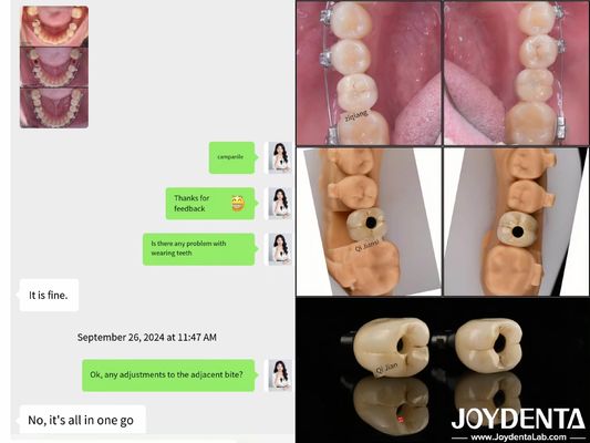 kopen Langdurige volledige boog tandheelkundige implantaten Endosese implantaten Lengte 10 mm-16 mm online vervaardiging