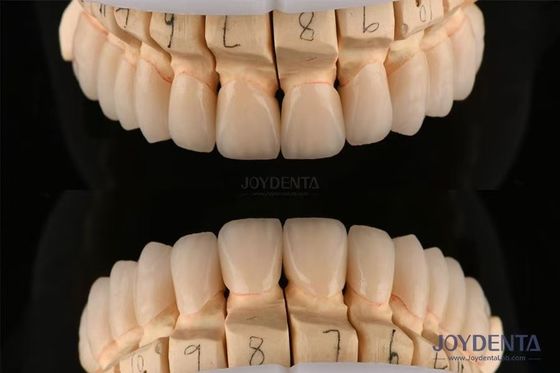 kopen Gepolijst gelaagd tandheelkundig zirconia 0,3-0,5 mm dik met CAD CAM technologie online vervaardiging