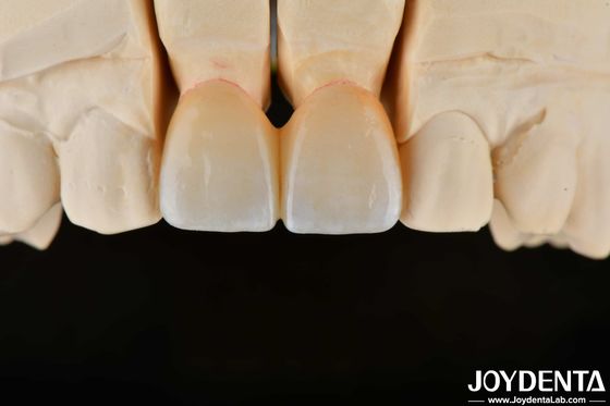 kopen 1350-1450°C Sintertemperatuur Schijferd Zirconia voor superieure biocompatibiliteit en warmtegeleiding online vervaardiging